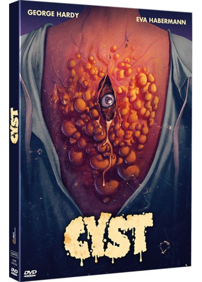 Cyst - DVD