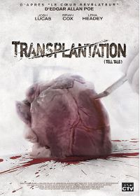 Transplantation - DVD
